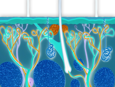 Psoriasis model and endpoints