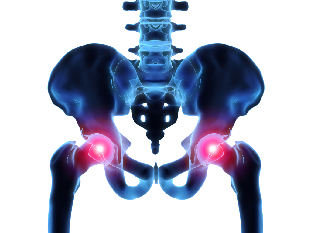 Models of Lower Back Pain amd Arthritis
