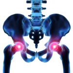Models of Lower Back Pain amd Arthritis